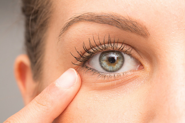 اختلال عملکرد غدد میبومی (MGD) یکی از عوامل خشکی چشم