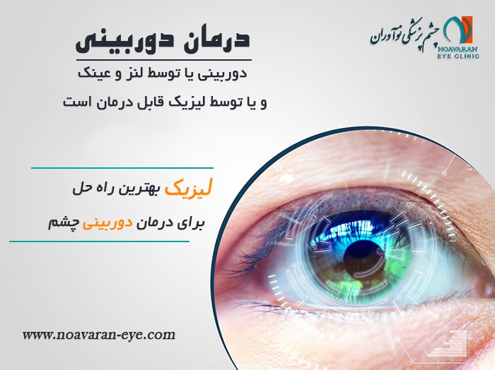 درمان دوربینی چشم  