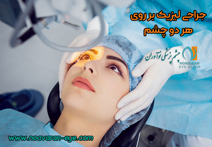 جراحی لیزیک بر روی هر دو چشم