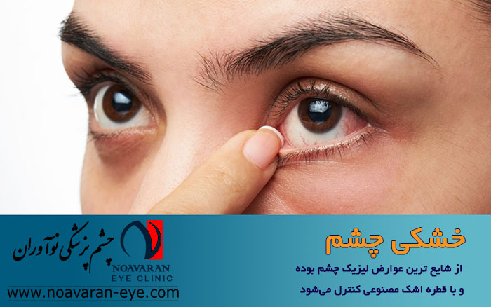 خشکی چشم از عوارض شایع عمل لیزیک چشم است 